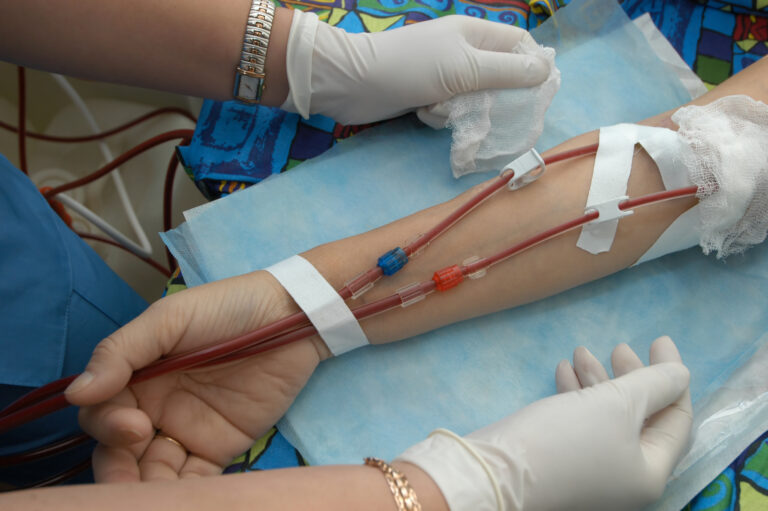 A medical professional administers dialysis treatment by connecting tubing to a patient's arm, ensuring proper care during the dialysis process.