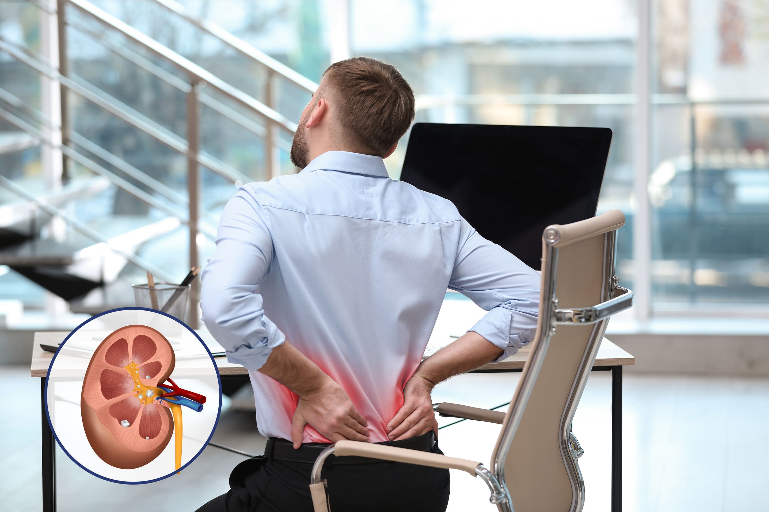 Signs That You May Have Kidney Stones